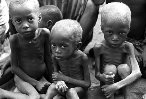 sterving-children-of-northern-uganda